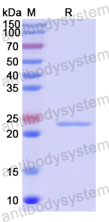 Recombinant Human NDE1 Protein, N-His