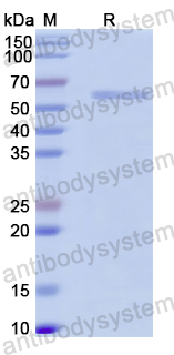 Recombinant Human P2RX4 Protein, N-GST & C-His