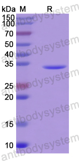 Recombinant Human P2RX4 Protein, N-His