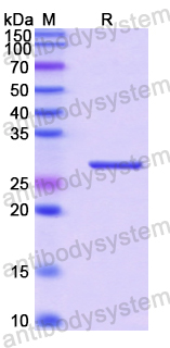 Recombinant Human IFT57 Protein, N-His-SUMO & C-Strep