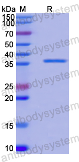 Recombinant Human MAT2B Protein, N-His