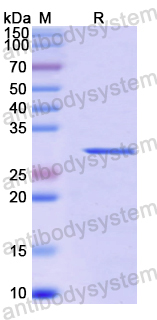 Recombinant Human IFT52 Protein, N-His