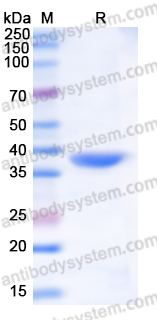 Recombinant Human FERMT2 Protein, N-His-SUMO & C-Strep