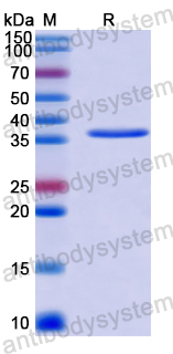 Recombinant Human EXOC2 Protein, N-GST & C-His