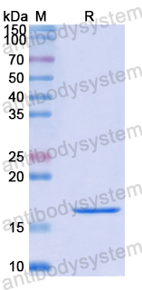 Recombinant Human KMT5A Protein, N-His
