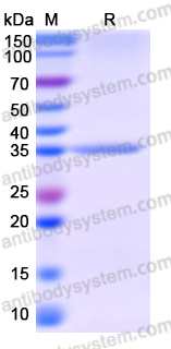 Recombinant Human SLC4A4 Protein, N-His-SUMO & C-Strep