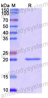 Recombinant Human TRIM44 Protein, N-His