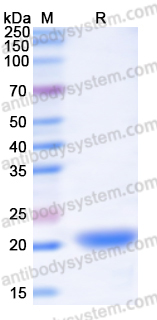 Recombinant Human STEAP4 Protein, N-His