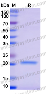 Recombinant Human TNFAIP8L2 Protein, N-His