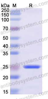 Recombinant Human MKS1 Protein, N-His