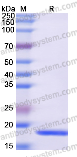 Recombinant Human RBM15 Protein, N-His