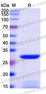 Recombinant Human RPGRIP1L Protein, N-His