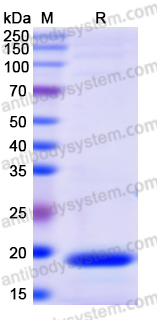 Recombinant Human TUT4 Protein, N-His