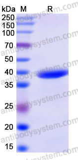 Recombinant Human SEPTIN9 Protein, N-His