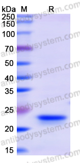 Recombinant Human CHCHD3 Protein, N-His