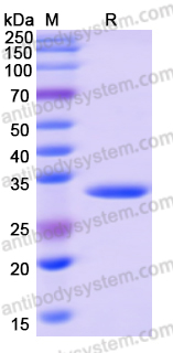 Recombinant Human PPP1R15B Protein, N-GST & C-His