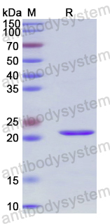 Recombinant Human RAB22A Protein, N-His