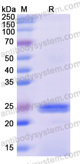 Recombinant Human SPHK2 Protein, N-His