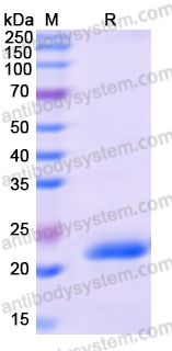 Recombinant Human CEP97 Protein, N-His