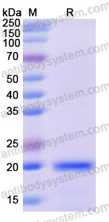 Recombinant Human COQ7 Protein, N-His