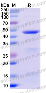 Recombinant Human DDX21 Protein, N-His