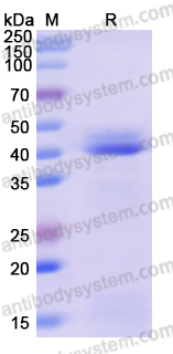 Recombinant Human KIF15 Protein, N-His