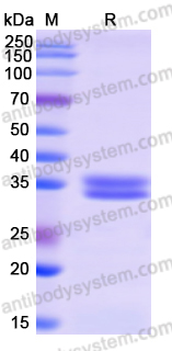 Recombinant Human UHRF1 Protein, N-His
