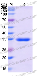 Recombinant Human STUB1 Protein, N-His