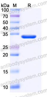 Recombinant Human STUB1 Protein, Tag free