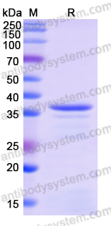 Recombinant Human AGTPBP1 Protein, N-His