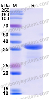 Recombinant Human DIAPH3 Protein, N-His