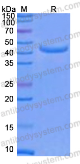 Recombinant Human RHOT2 Protein, N-His