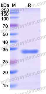Recombinant Human NLRX1 Protein, N-His