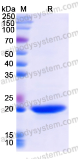 Recombinant Human RASSF6 Protein, N-His