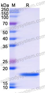 Recombinant Human UBE2T Protein, N-His