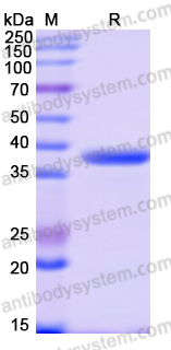 Recombinant Human ARHGEF25 Protein, N-His