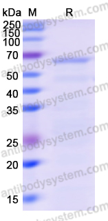 Recombinant Human USP13 Protein, N-His
