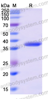 Recombinant Human KIF3A Protein, N-His