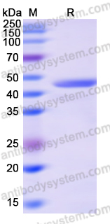 Recombinant Human L2HGDH Protein, N-His