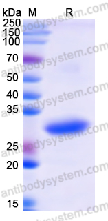 Recombinant Human MAD2L2 Protein, N-His