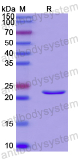 Recombinant Human RAB18 Protein, N-His