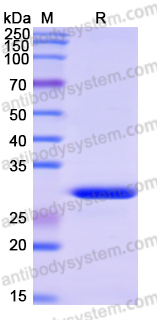 Recombinant Human ROBO1 Protein, N-His-SUMO & C-Strep