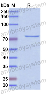 Recombinant Human VPS33B Protein, N-His