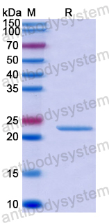 Recombinant Human TRIM31 Protein, N-His-SUMO & C-Strep