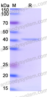 Recombinant Human VPS16 Protein, N-His