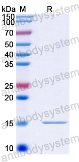 Recombinant Human PLEK2 Protein, N-His