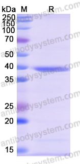 Recombinant Human FBXO22 Protein, N-His
