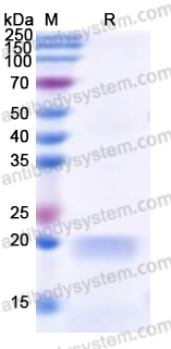 Recombinant Human KATNB1 Protein, N-His