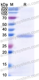 Recombinant Human PINX1 Protein, N-His-SUMO & C-Strep