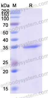 Recombinant Human POT1 Protein, N-His